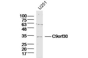 Lane 1: U251 lysates probed with C9orf30 Polyclonal Antibody, Unconjugated  at 1:300 overnight at 4˚C. (MSANTD3 anticorps  (AA 1-100))