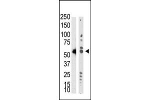 Western Blotting (WB) image for anti-tRNA Aspartic Acid Methyltransferase 1 (TRDMT1) (AA 300-400) antibody (ABIN356546) (Dnmt2 anticorps  (AA 300-400))