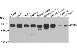 Western blot analysis of extracts of various cell lines, using CCT3 antibody. (CCT3 anticorps)