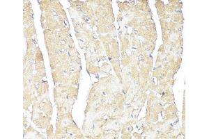 Immunohistochemistry of paraffin-embedded Mouse heart using ATP1B1 Polyclonal Antibody at dilution of 1:100 (40x lens).