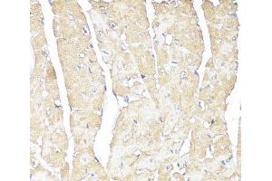 Immunohistochemistry of paraffin-embedded Mouse heart using ATP1B1 Polyclonal Antibody at dilution of 1:100 (40x lens). (ATP1B1 anticorps)