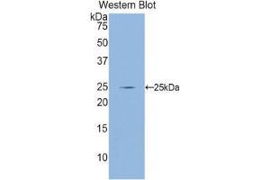 Western Blotting (WB) image for anti-Glutamate-Cysteine Ligase, Catalytic Subunit (GCLC) (AA 435-636) antibody (ABIN1858973) (GCLC anticorps  (AA 435-636))