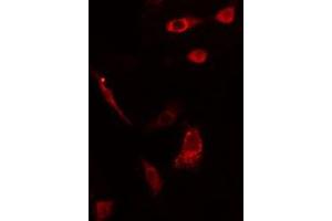 ABIN6275561 staining HepG2 cells by IF/ICC.
