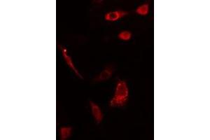 ABIN6275561 staining HepG2 cells by IF/ICC. (SH2D2A anticorps  (C-Term))