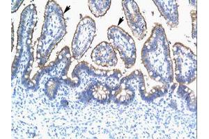 Image no. 2 for anti-Tripartite Motif Containing 15 (TRIM15) (AA 141-190) antibody (ABIN202591) (TRIM15 anticorps  (AA 141-190))