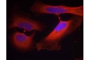 Immunofluorescence staining of methanol-fixed HeLa cells using Keratin 8 (Phospho-Ser74) Antibody (E011307, Red) (KRT8 anticorps  (pSer74))
