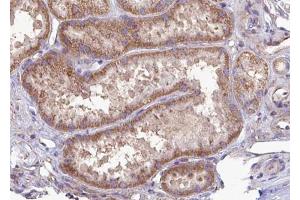 ABIN6272980 at 1/100 staining Mouse kidney tissue by IHC-P.