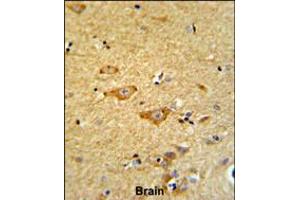 Formalin-fixed and paraffin-embedded human brain reacted with OMD Antibody , which was peroxidase-conjugated to the secondary antibody, followed by DAB staining. (Osteomodulin anticorps  (AA 234-263))