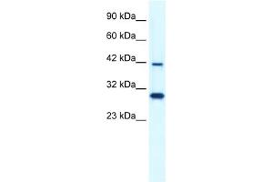 WB Suggested Anti-PREB Antibody Titration:  0. (PREB anticorps  (N-Term))