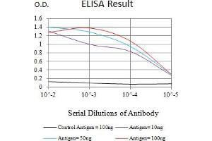Black line: Control Antigen (100 ng),Purple line: Antigen (10 ng), Blue line: Antigen (50 ng), Red line:Antigen (100 ng)