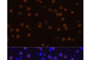 Immunofluorescence analysis of Mouse brain using MEF2C Polyclonal Antibody at dilution of 1:100 (40x lens). (MEF2C anticorps)