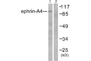 Western blot analysis of extracts from HepG2 cells, using Ephrin-A4 antibody (ABIN5976388). (EFNA4 anticorps  (C-Term))