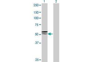 Western Blot analysis of GGT6 expression in transfected 293T cell line by GGT6 MaxPab polyclonal antibody. (gGT6 anticorps  (AA 1-493))