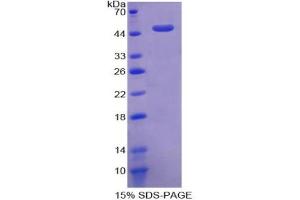 SDS-PAGE analysis of Human ACVR1 Protein.