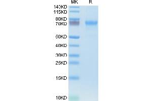 Human CXCL16 on Tris-Bis PAGE under reduced condition.