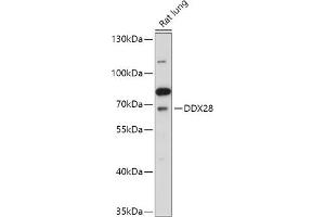 Western blot analysis of extracts of Rat lung, using DDX28 antibody (ABIN7266693) at 1:1000 dilution. (DDX28 anticorps  (AA 371-540))