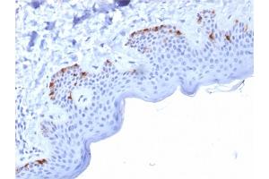 Formalin-fixed, paraffin-embedded human Skin stained with gp100 Mouse Monoclonal Antibody (PMEL/2037).