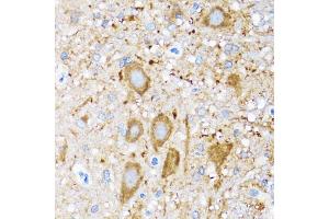 Immunohistochemistry of paraffin-embedded mouse spinal cord using HSPH1 antibody. (HSPH1 anticorps)