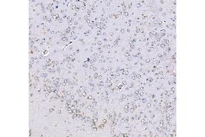 IHC analysis of Optineurin using anti-Optineurin antibody (ABIN3042498). (OPTN anticorps  (AA 241-577))