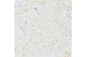 Immunohistochemistry of paraffin-embedded rat brain using MAP1LC3B antibody.