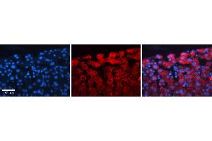 Rabbit Anti-ACLY Antibody   Formalin Fixed Paraffin Embedded Tissue: Human Liver Tissue Observed Staining: Cytoplasm in hepatocytes Primary Antibody Concentration: 1:100 Other Working Concentrations: N/A Secondary Antibody: Donkey anti-Rabbit-Cy3 Secondary Antibody Concentration: 1:200 Magnification: 20X Exposure Time: 0.