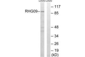 Western blot analysis of extracts from LOVO cells, using RHG9 antibody. (ARHGAP9 anticorps)