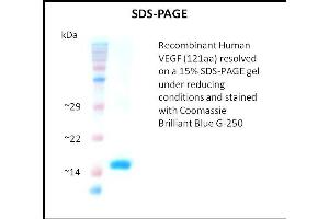 SDS-PAGE (SDS) image for Vascular Endothelial Growth Factor (VEGF) (Active) protein (ABIN5509529) (VEGF Protéine)