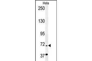 RAD26 Antibody (N-term) (ABIN654126 and ABIN2844001) western blot analysis in Hela cell line lysates (35 μg/lane). (ERCC6 anticorps  (N-Term))