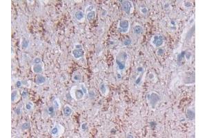 Detection of TDH in Human Cerebrum Tissue using Polyclonal Antibody to L-Threonine Dehydrogenase (TDH) (Tdh anticorps  (AA 1-229))