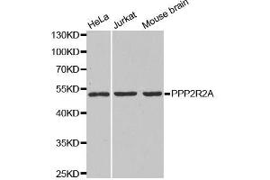 Western blot analysis of extracts of various cell lines, using PPP2R2A antibody. (PPP2R2A anticorps  (AA 1-447))