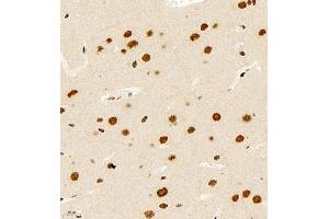 Immunohistochemistry of paraffin embedded rat brain using smad62024 (ABIN7075629) at dilution of 1:1000 (400x lens)