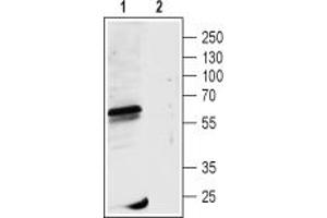 Western blot analysis of rat eye lysate:1.
