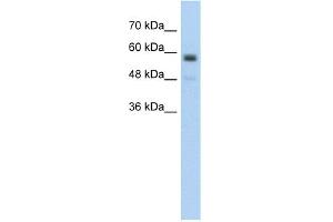 WB Suggested Anti-C9orf127 Antibody Titration:  5. (TMEM8B anticorps  (Middle Region))