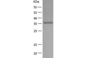 Western Blotting (WB) image for Platelet Derived Growth Factor D (PDGFD) (AA 24-370) protein (His-IF2DI Tag) (ABIN7124471)
