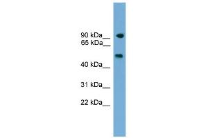 WB Suggested Anti-Parp8 Antibody Titration: 0. (PARP8 anticorps  (C-Term))