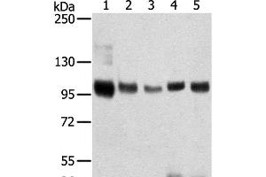 Western Blot analysis of Mouse brain and Human brain tissue, Human prostate tissue, Human fat and placenta tissue using SORT1 Polyclonal Antibody at dilution of 1:200 (Sortilin 1 anticorps)