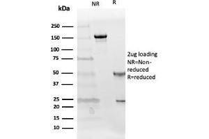 SDS-PAGE Analysis Purified Follistatin Mouse Monoclonal Antibody (FST/4281). (Follistatin anticorps)