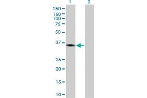 Western Blot analysis of PTGER2 expression in transfected 293T cell line by PTGER2 MaxPab polyclonal antibody. (PTGER2 anticorps  (AA 1-358))