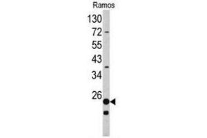 Western blot analysis of RPS9 antibody (C-term) in Ramos cell line lysates (35ug/lane).