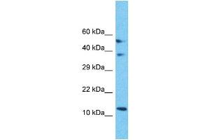 Western Blotting (WB) image for anti-Mitochondrial Ribosomal Protein S18C (MRPS18C) (C-Term) antibody (ABIN2791674) (MRPS18C anticorps  (C-Term))