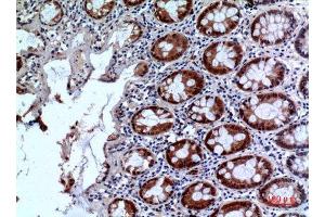 Immunohistochemistry (IHC) analysis of paraffin-embedded Human Colon, antibody was diluted at 1:100. (IL1R2 anticorps  (Internal Region))