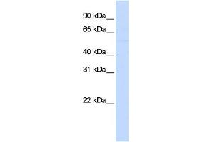 WB Suggested Anti-LRRC24 Antibody Titration:  0. (LRRC24 anticorps  (N-Term))