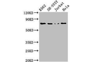 Western Blot Positive WB detected in: K562 whole cell lysate, SH-SY5Y whole cell lysate, Jurkat whole cell lysate, Hela whole cell lysate All lanes: PRKCB antibody at 3 μg/mL Secondary Goat polyclonal to rabbit IgG at 1/50000 dilution Predicted band size: 77, 78 kDa Observed band size: 77 kDa (PKC beta anticorps  (AA 517-643))