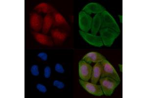 ABIN6256781 and ABIN6267510 staining Hela cells(30 min of UV treatment) by IF/ICC.