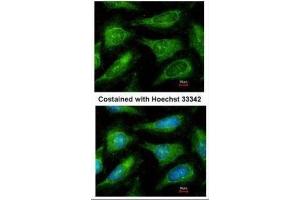 ICC/IF Image Immunofluorescence analysis of methanol-fixed HeLa, using c-Yes, antibody at 1:200 dilution. (YES1 anticorps  (Center))