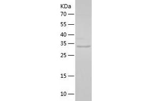 Western Blotting (WB) image for Aldo-Keto Reductase Family 1, Member B1 (Aldose Reductase) (AKR1B1) (AA 1-316) protein (His tag) (ABIN7121781) (AKR1B1 Protein (AA 1-316) (His tag))