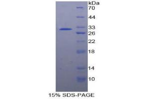 SDS-PAGE analysis of Human PTPRJ Protein. (PTPRJ Protéine)