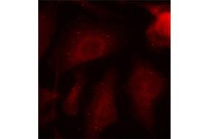 Immunofluorescence staining of methanol-fixed HeLa cells using Phospho-MAPT-S404 antibody (ABIN2987503). (MAPT anticorps  (pSer404))