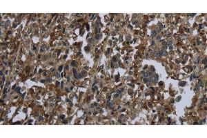 anti-Glutamate-Ammonia Ligase (GLUL) antibody