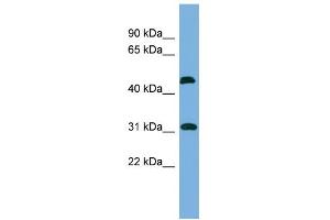 WB Suggested Anti-CTDSP2 Antibody Titration: 0. (CTDSP2 anticorps  (N-Term))